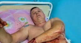 У Покровську під час ракетного удару поранило поліцейського — героя фільму “20 днів в Маріуполі”